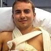 Jorge Lorenzo se rompe la clavícula