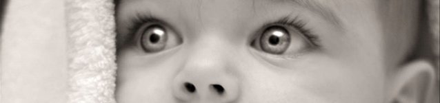 Síndrome de Beckwith-Wiedemann