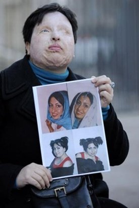 El antes y el después de la víctima