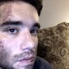 Una pareja gay es atacada a la salida de un bar