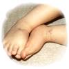 Sindrome de Rubinstein Taybi