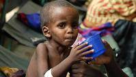 8.000 niños al día mueren por desnutrición