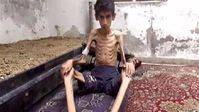Madaya está muerta de hambre