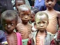 16.000 niños mueren por pobreza cada día