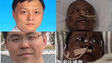 Dos médicos chinos cambian su color de piel a negra tras superar el coronavirus