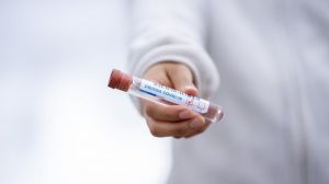 Un test serológico que diferencia personas vacunadas de las que han padecido Covid-19