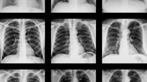 Inteligencia artificial para detectar la COVID-19