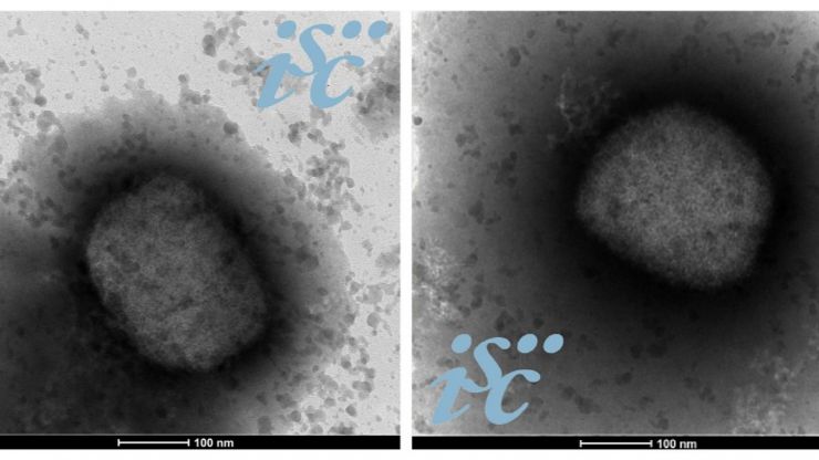 Investigadores españoles obtienen la secuencia completa del genoma del virus de la viruela del mono