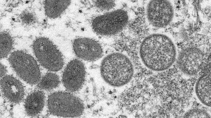 La OMS al habla: De la 'emergencia' de la viruela del mono al origen y estado del COVID-19