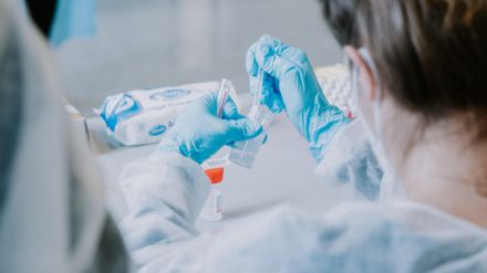 Estudios: Los anticuerpos contra el SARS-CoV-2 pueden persistir casi dos años tras la enfermedad