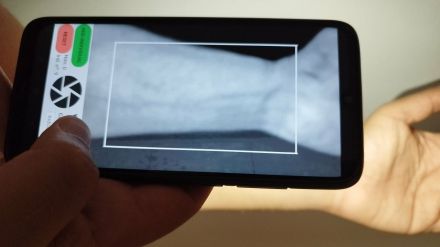 Reconocimiento de personas con imágenes de venas tomadas desde el móvil