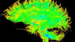 Hay que controlar los factores de riesgo cardiovascular para prevenir el alzhéimer