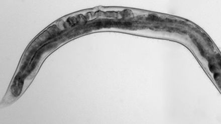 Ciencia: Un gusano como herramienta esencial para elaborar futuras terapias contra el párkinson