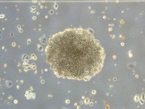 Nuevo mecanismo molecular descubierto que afecta la eficacia de la quimioterapia