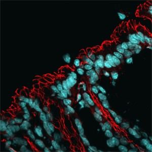 Identifican un mecanismo celular que afecta la microbiota intestinal y eleva el riesgo de enfermedades