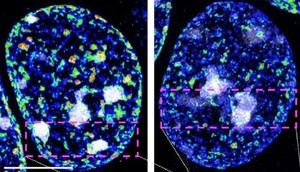 Identifican enzimas que mantienen la identidad de las neuronas