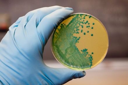 CSIC desarrolla un método innovador y seguro para eliminar listeria en alimentos