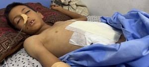 Crisis en Gaza: Hospitales colapsan y emergen enfermedades raras entre la población