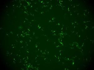 Descubren en gusanos un mecanismo que les permite recordar infecciones virales y defenderse de reinfecciones