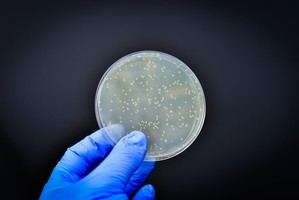 Estudio del CSIC revela resistencia bacteriana en la cadena alimentaria europea