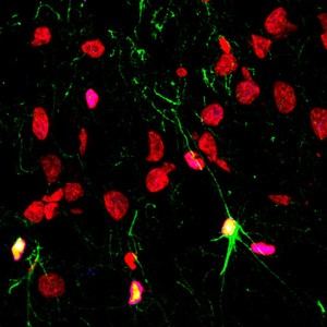 Impacto negativo del alcohol y drogas en la neurogénesis cerebral en trastornos psiquiátricos