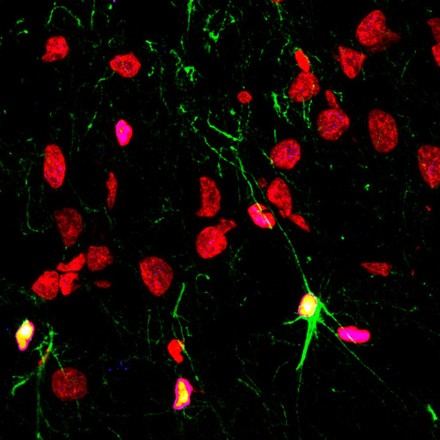 Impacto negativo del alcohol y drogas en la neurogénesis cerebral en trastornos psiquiátricos
