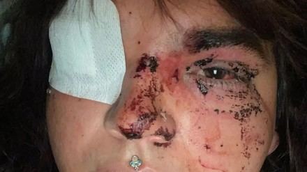 La actual Miss Trans Zamora sufre una brutal agresión tránsfoba en León