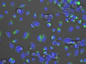 Desarrollan un compuesto que combate la metástasis del cáncer de mama en ratones