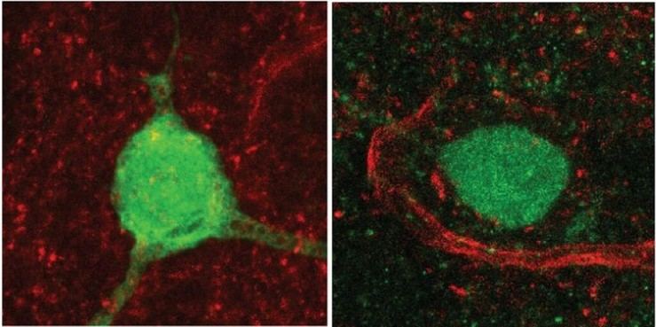 Identifican cómo una mutación genética relacionada con el autismo afecta la hormona de la sociabilidad