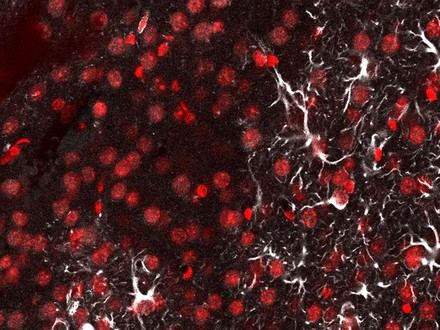 Desarrollan una sonda ultrafina que detecta metástasis cerebral en ratones mediante luz